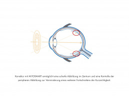 MiYOSMART Illustrationen 2 Uai