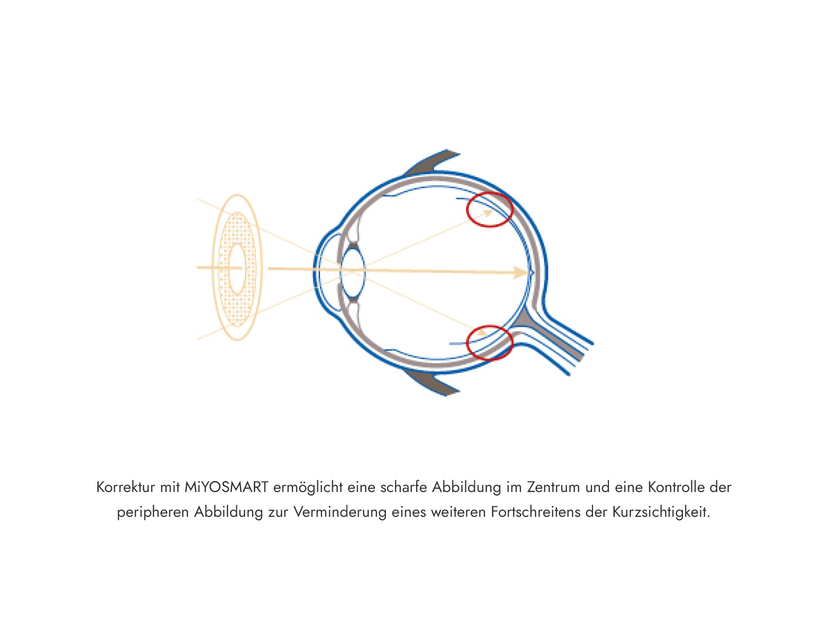MiYOSMART Illustrationen 2